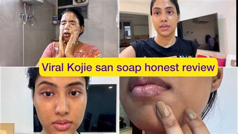 kojie san soap results|My Sincere Review of Kojie San Skin Lightening Soap (w/ My .